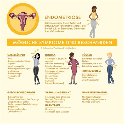 endometriose symptome rückenschmerzen